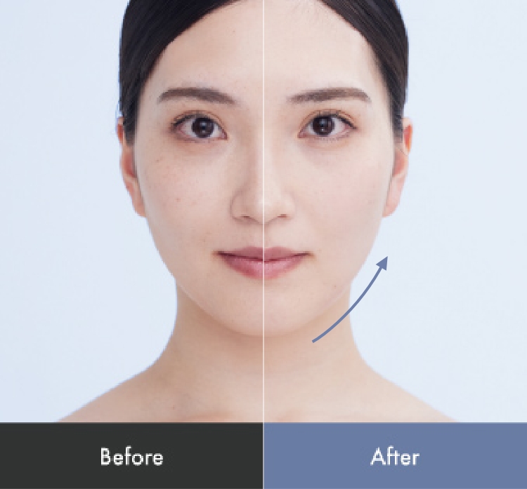 1分使用した様子 Before After