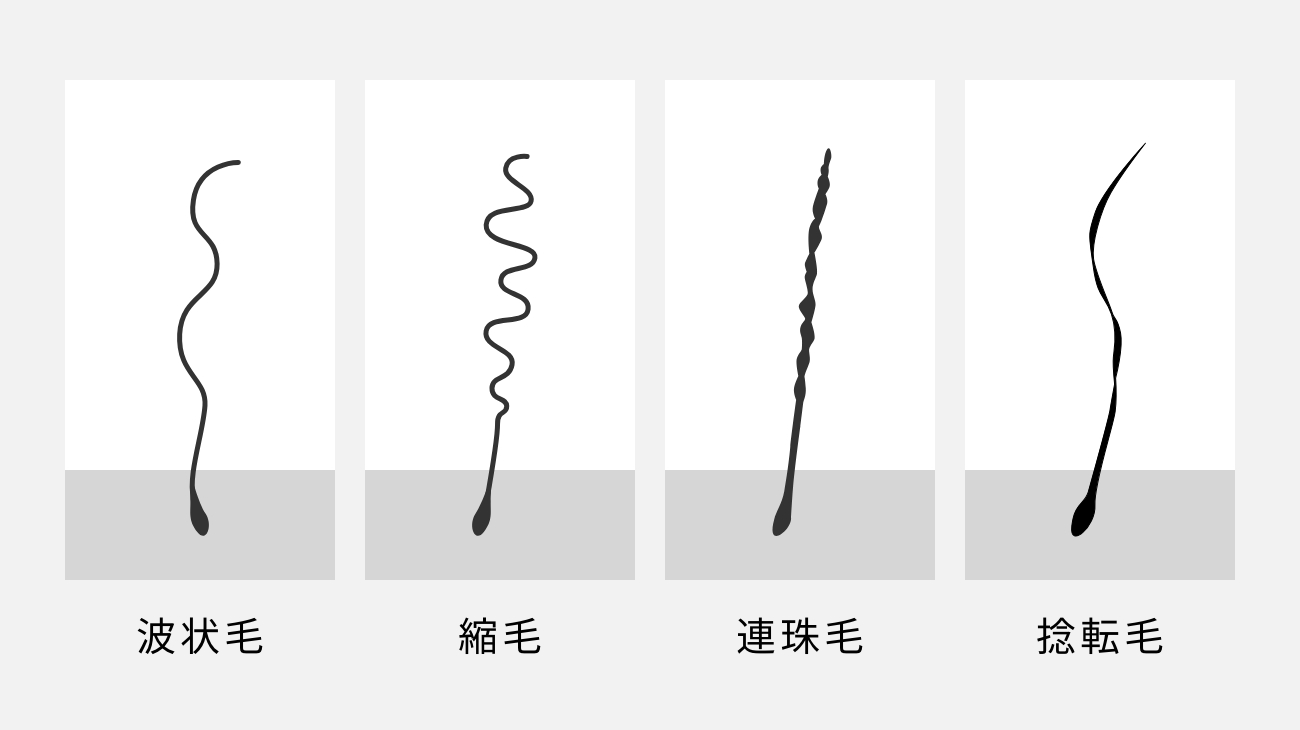 くせ毛の種類